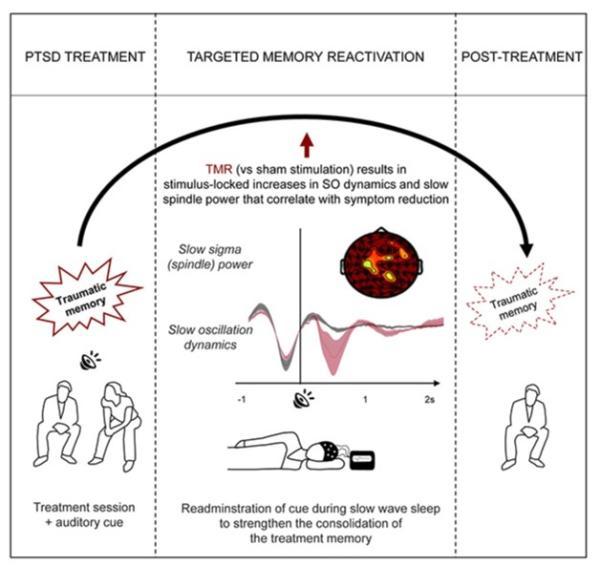 روش جدیدی برای کاهش علائم PTSD